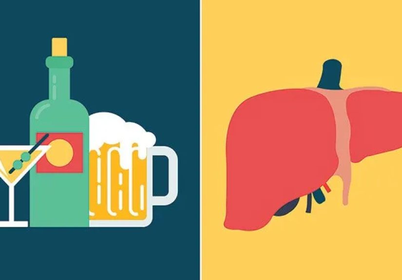 What is Alcohol-Related Liver Disease?