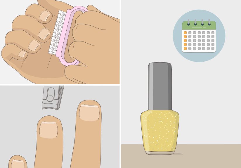 3 Ways to Get Rid of Nail Fungus