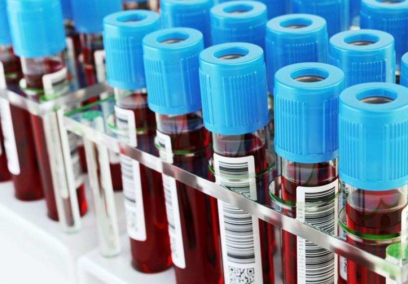 Amylase and Lipase Tests: Preparation, Procedure, and Results