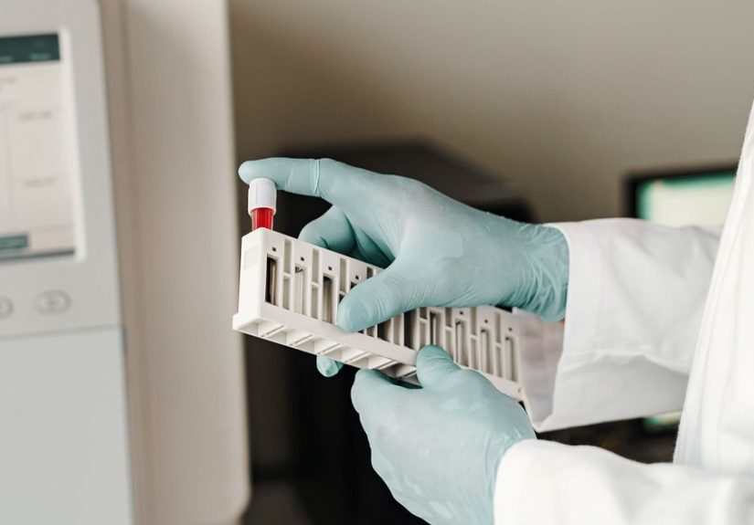 Can Narcolepsy Be Diagnosed with a Blood Test?