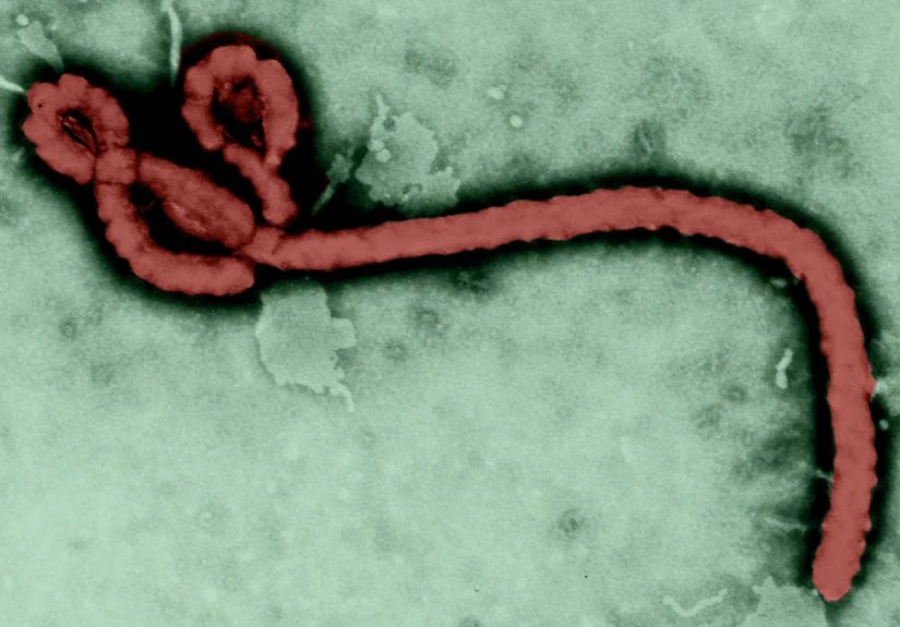Ebola Outbreaks: Causes, Prevention, and Control