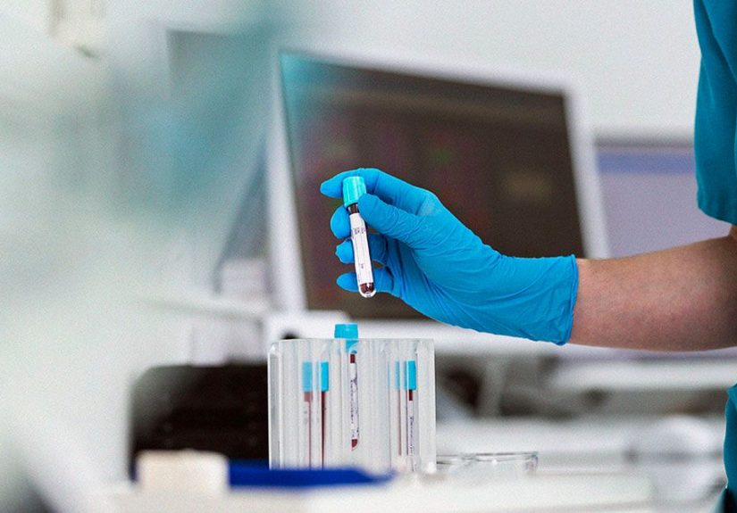 How long does it take to show symptoms of HIV? Timeline and more