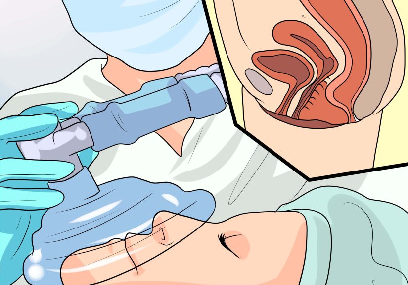 How to Not Wet Yourself when Laughing: 10 Proven Home Remedies