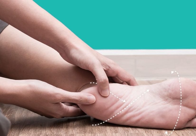 Plantar Fasciitis Taping: Benefits, Materials, How To, and Diagram