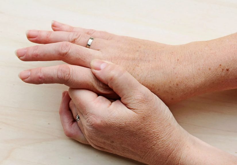 Psoriatic Arthritis Joint and Skin Tips