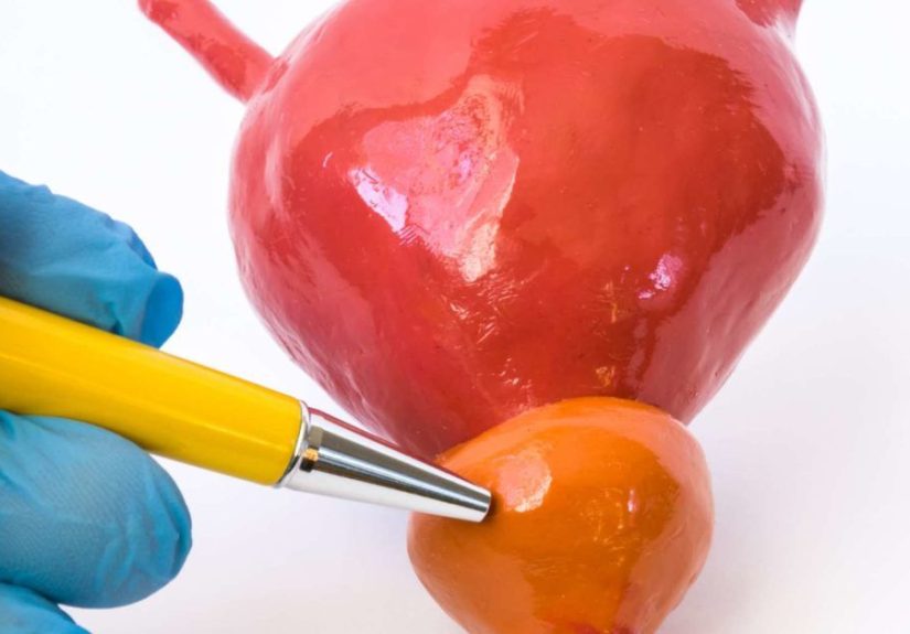 Acute prostatitis: Symptoms, treatment, and home remedies