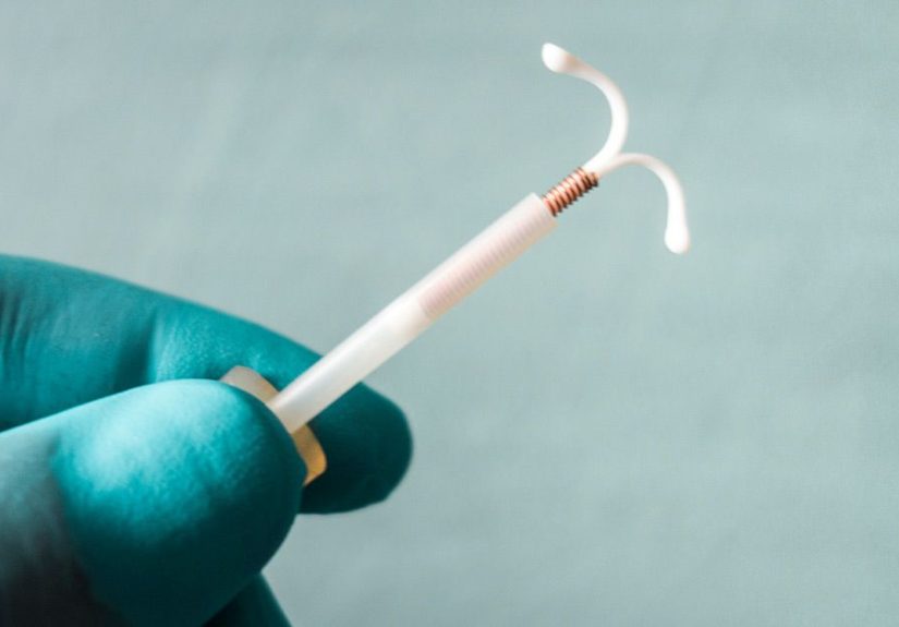 IUD Pain Management: CDC Updates Recommendations