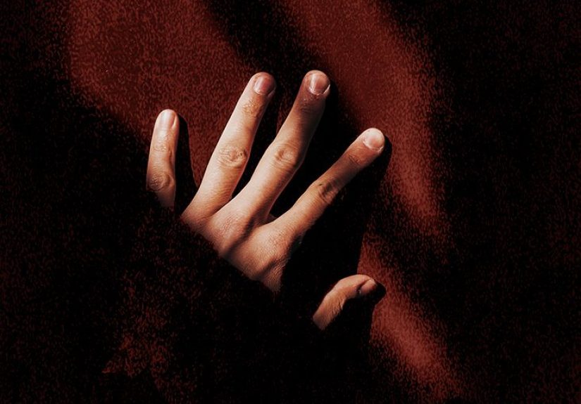 Nail Psoriasis: Definition, Treatment, and Home Remedies