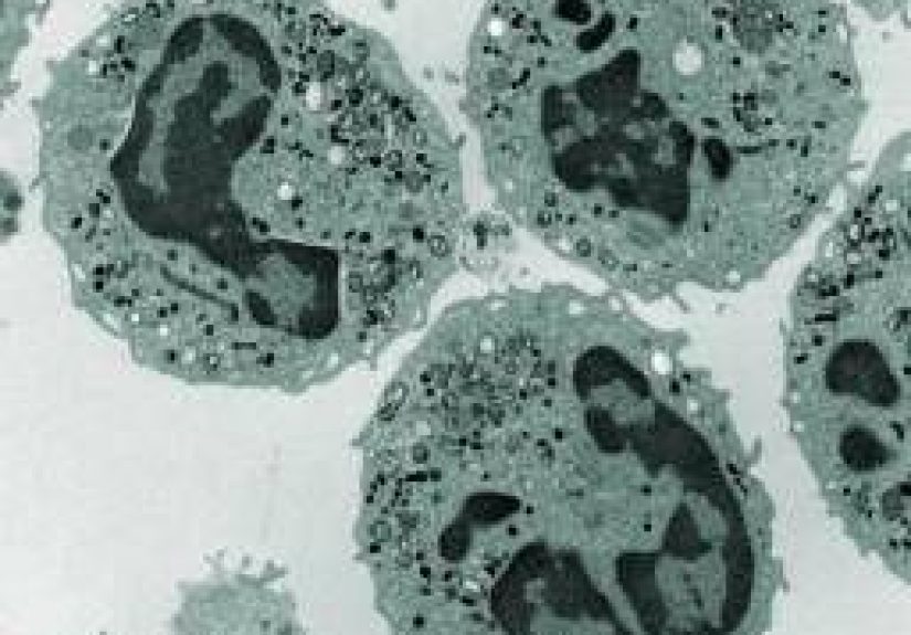 Neutropenia: Causes, Diagnosis, and Treatment