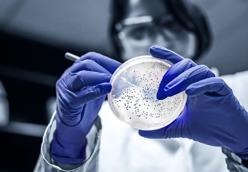 Psoriatic arthritis and the microbiome connection