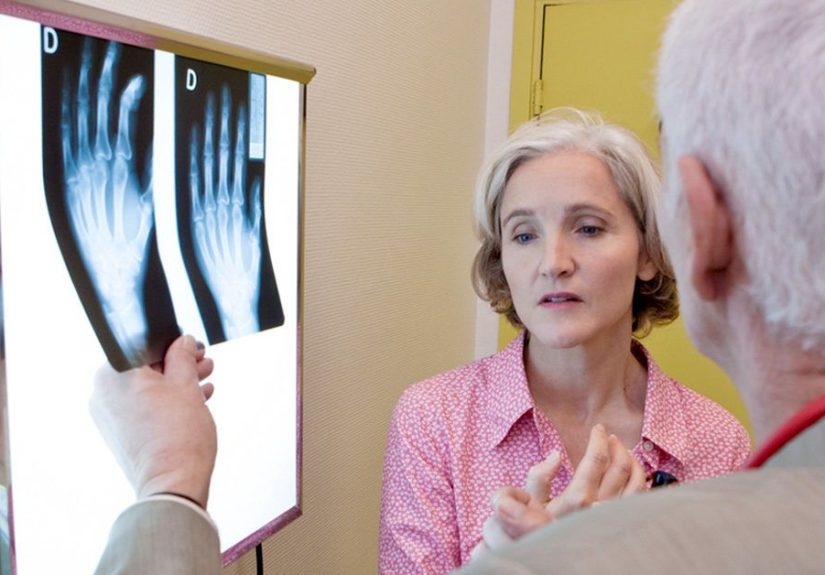 Rheumatoid Arthritis Diagnosis: Tests, Criteria, and More