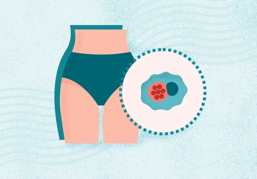 Sexually Transmitted Infections (STIs) Resource Center - All Articles