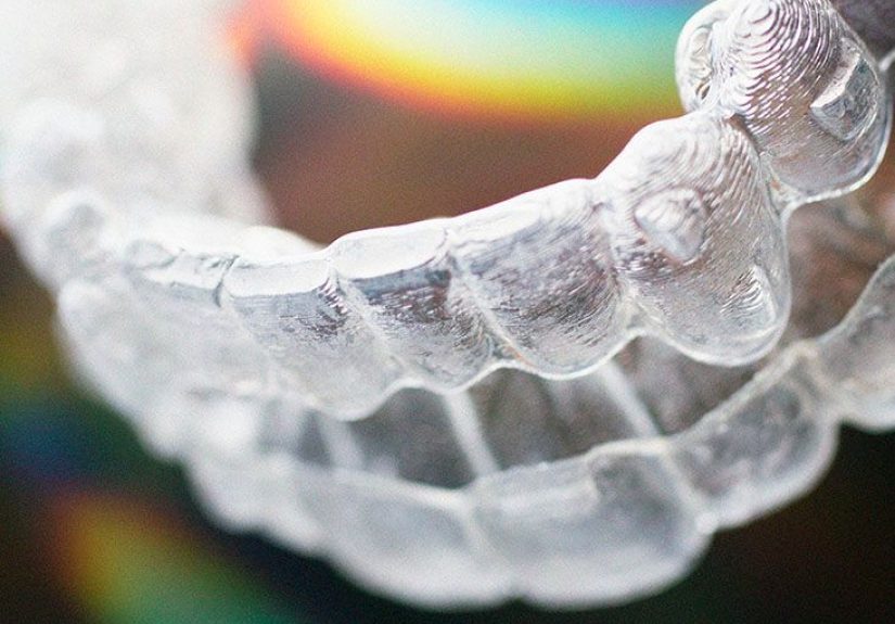 Teeth straightening retainers: What you need to know