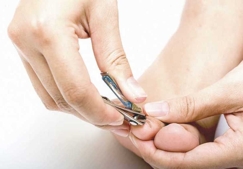 Thick Toenails: Diagnosis, Pictures, Causes, and Treatments