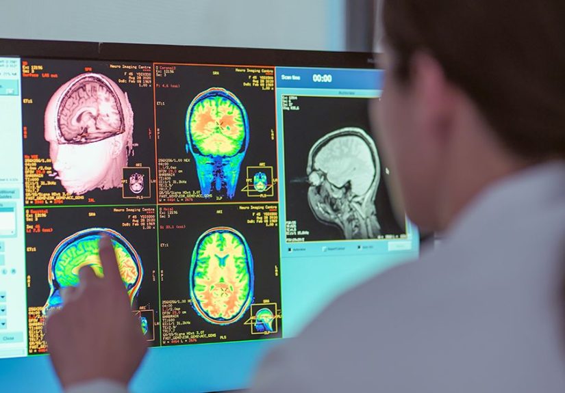 Brain Differences in People with OCD: What to Know