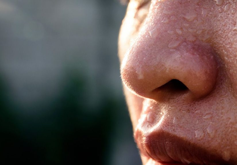 How to Stop Sweating on the Face: Treatments, Financial Help